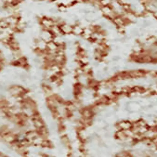 Coral And Ivory Floral Washable Area Rug With UV Protection Photo 7